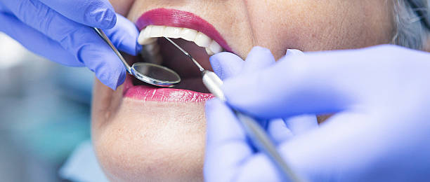 Best Broken or Chipped Tooth Repair in Cascade, IA